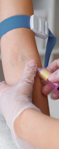 Coleta de sangue realizada por profissional do Laboratório Análise